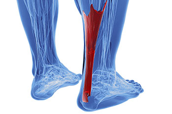 achilles tendon treatment in the Bellaire, TX 77401 area